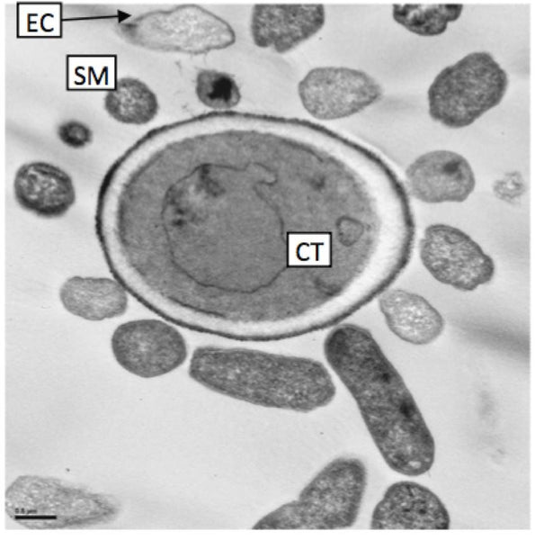 gut fungus under an electron microscope - Dr. Ghannoum