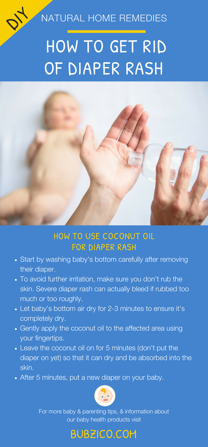 Your baby is in diapers 24/7 up until they start potty training so it’s inevitable that they’ll get diaper rash at some point in their little lives. No matter what diaper you put them in (cloth, disposable) or what cream you use, it’s bound to happen at some point. Click to learn the best 6 DIY #diaperrash remedies using cornstarch & coconut oil to give your #newborn baby instant relief from #BubziCo blog. | #BabyHealth Care #BabyTips #NewbornCare #NewMomAdvice #NewMommy #NewMomAdvice 