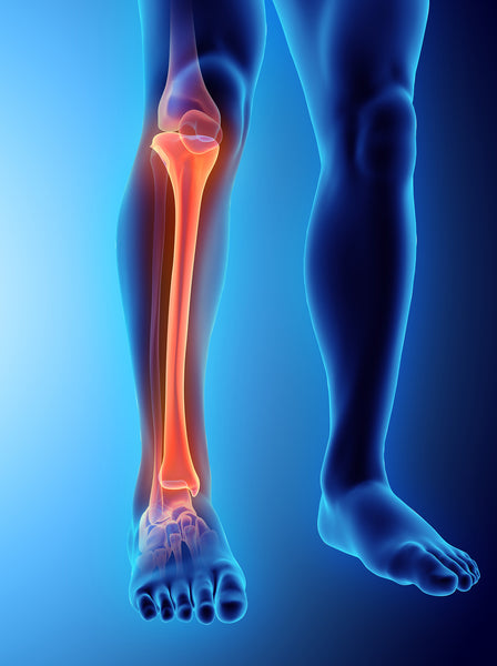 Fracture running tibial plateau stress Medial tibial