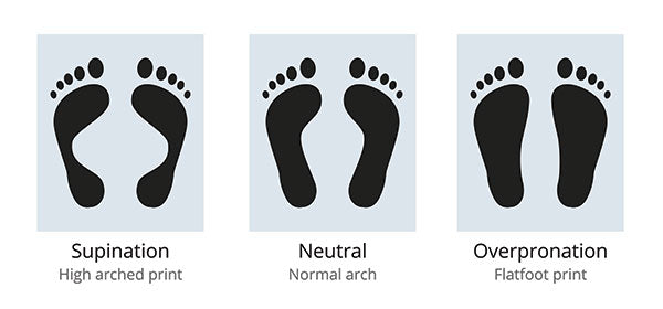 Pronation and supination. How to recognise and solve them