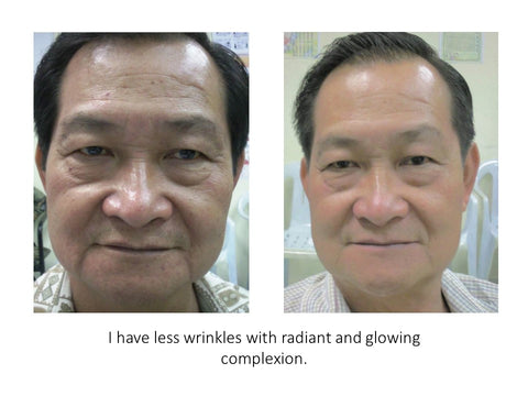 eumora soap testimonial for wrinkles