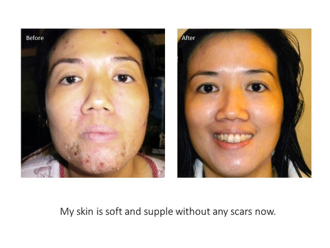 eumora soap testimonial for soft skin