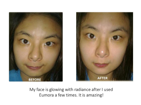 eumora soap testimonial for radiant face