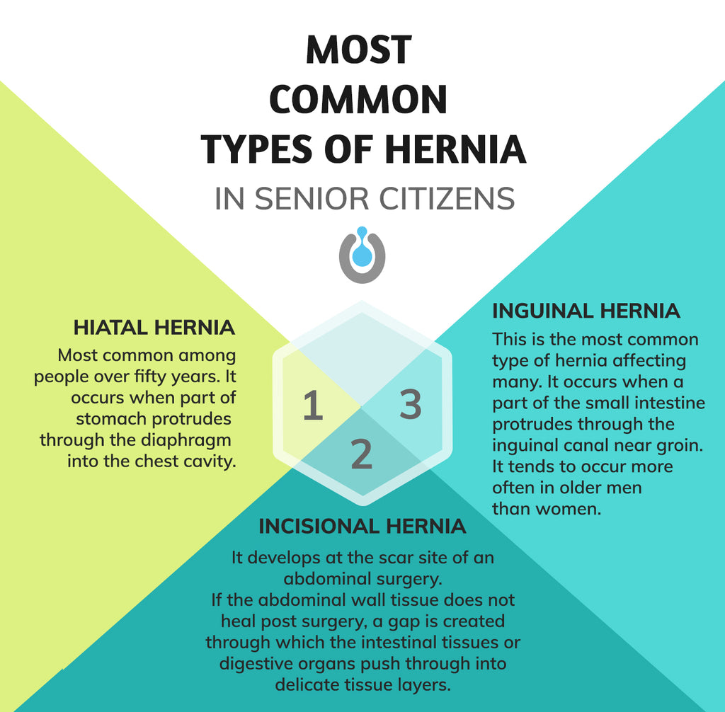 infographic on most common types of hernia in the elderly - hiatal, inguinal, incisional
