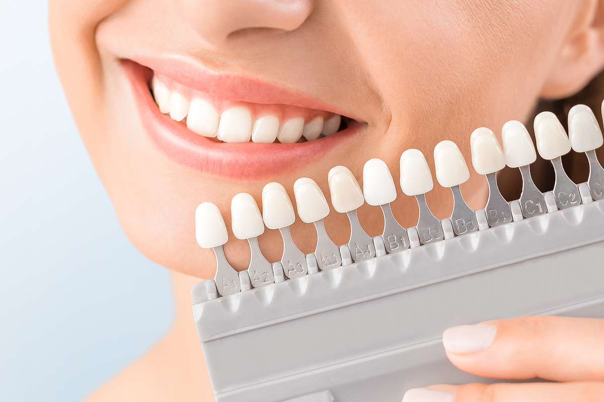 Do Whitening Strips Work? The Truth About Whitening Products