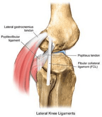  Lateral Collateral Ligament (LCL). 