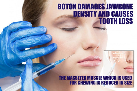 Botox is now believed to damage your jawbone and cause tooth loss