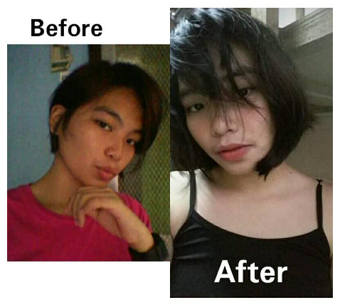 Before After Glutathione Roan