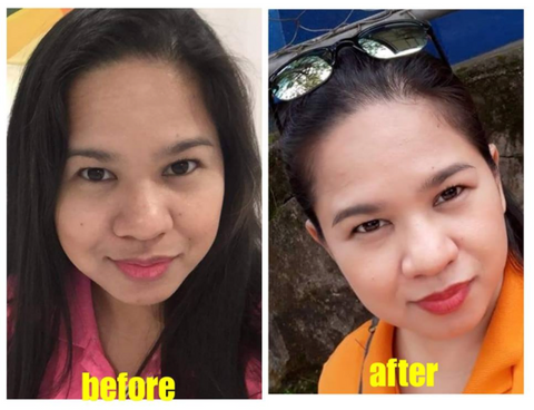 whitening glutathione megawhite