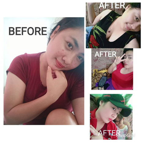 whitening glutathione