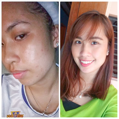 glutathione skin whitening megawhite