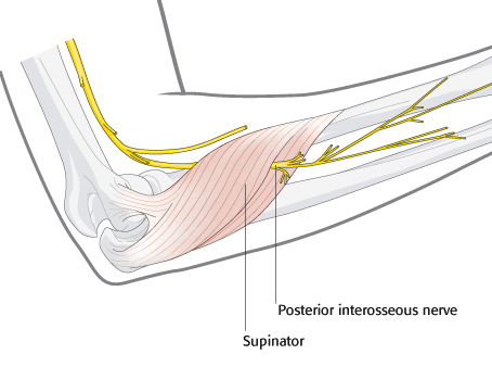 diagram of the posterior interosseous nerve