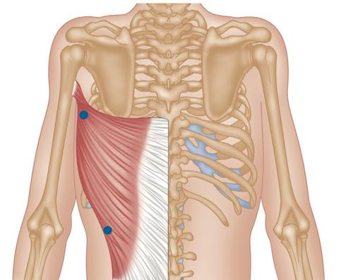 Diagram showing the location of trigger points in the latissimus dorsi