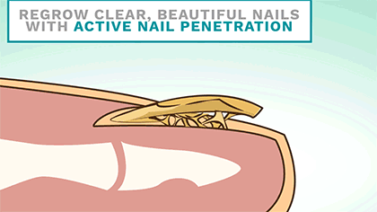 Nail Treatment