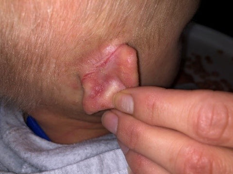 Seborrheic Dermatitis: A greasy, yellowish crusty scales on the surface of the skin behind the ear