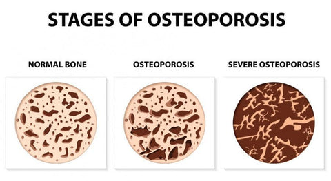 olive oil shown to protect bone mass