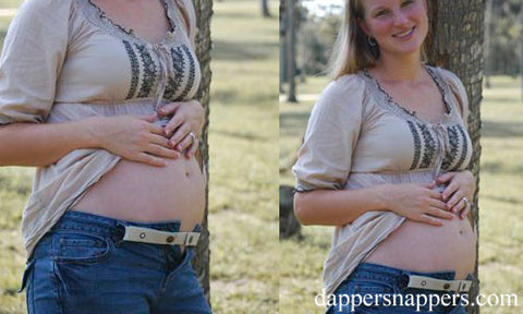 Snap Fastener Buttons Elastic Cincher Belt for Maternity Pregnant Mom Moms