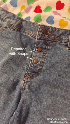 Repair Jean Buttons or Zippers with Snap Fasteners - KAMsnaps®