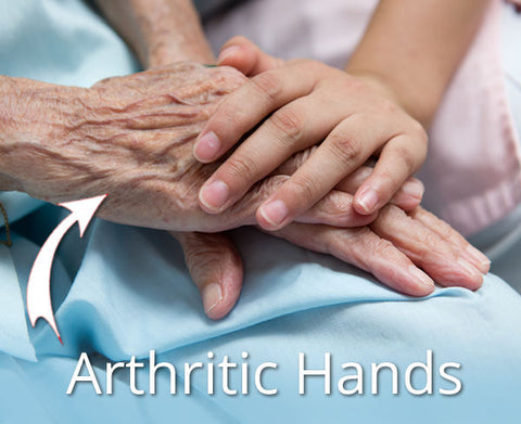 Arthritic hands, fingers and thumbs pain can be most debilitating