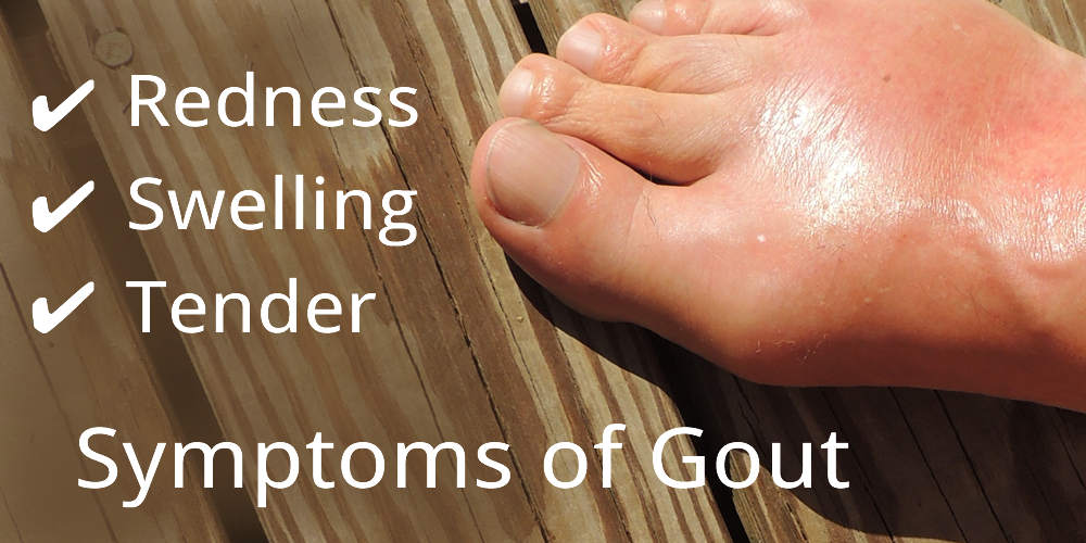 Symptoms of Gout  in Your Feet