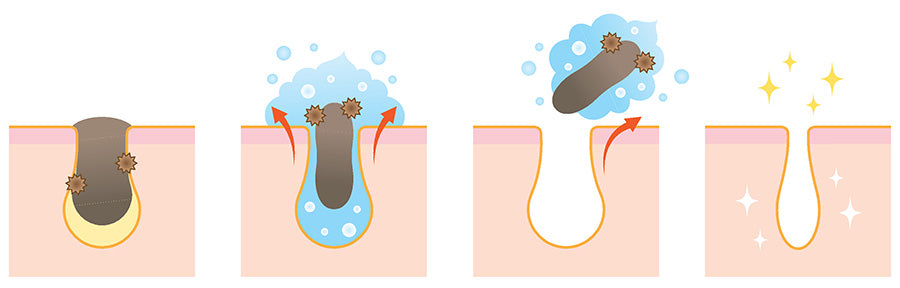 Infographic displaying how an exfoliating scrub clears pores