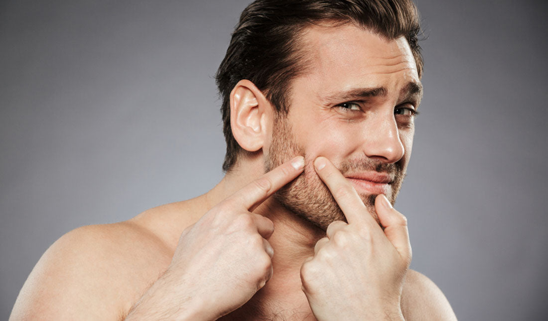 portrait of a man squeezing pimple