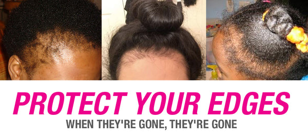 4 Easy Ways To Keep And Grow Back Your Edges Thepuffcuff