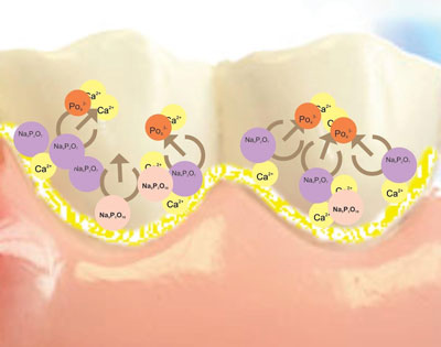Periogen preventing dental plaque