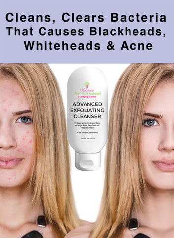 Victoria’s Celebrity ADVANCED EXFOLIATING CLEANSER  ANTI-AGING and ACNE