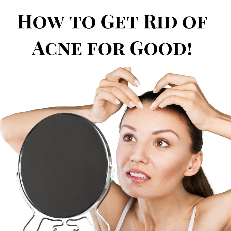 How To Get Rid Of Acne Quickly And For Good A Complete List Of Tips Luminositie 