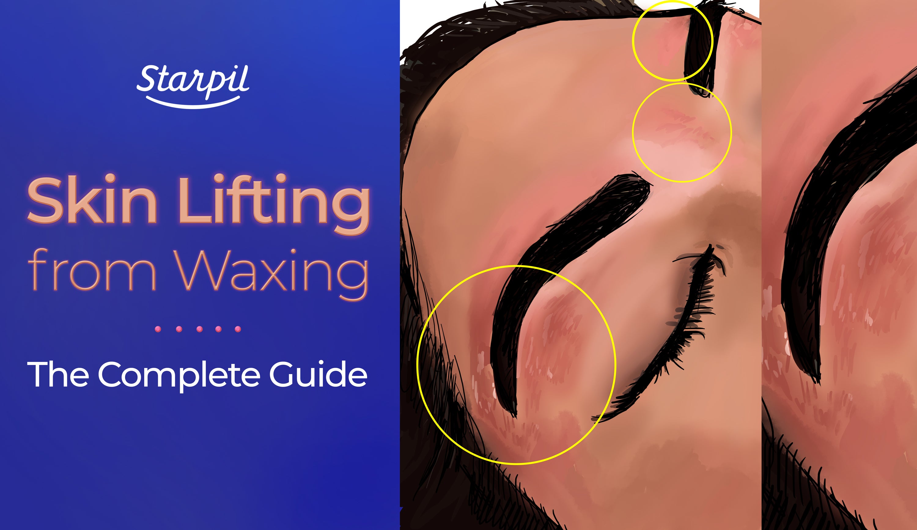 Skin Lifting from Waxing - Starpil Wax