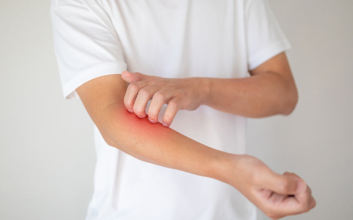 खुजली दूर करने के बेहतरीन घरेलु उपाय – How To Treat Skin Itching In Hi –  SkinKraft