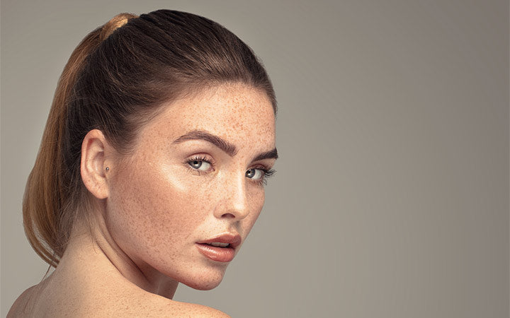 Naturally freckles to how remove and moles How to