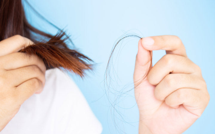 Woman showing hair loss