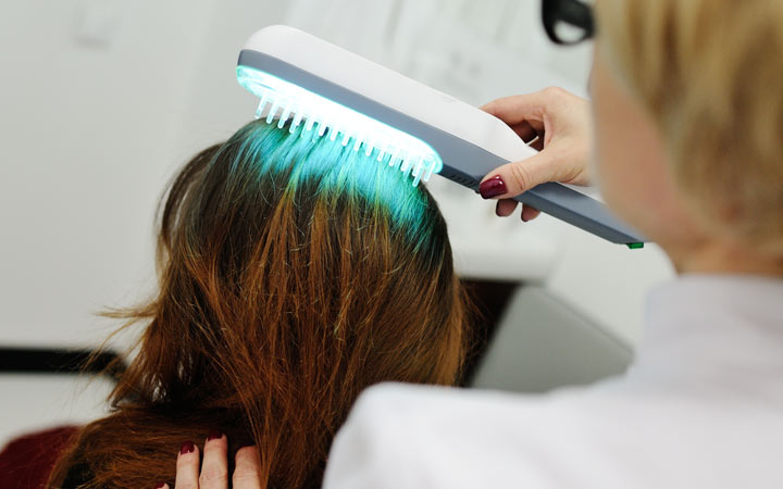 Light therapy for scalp eczema