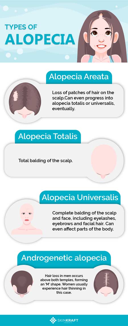 Types of alopecia 