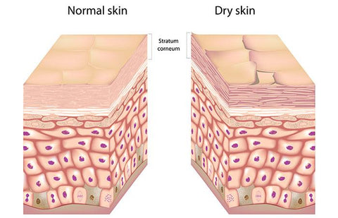 Symptoms of dry skin