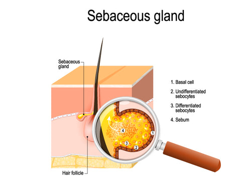  overactive sebaceous glands