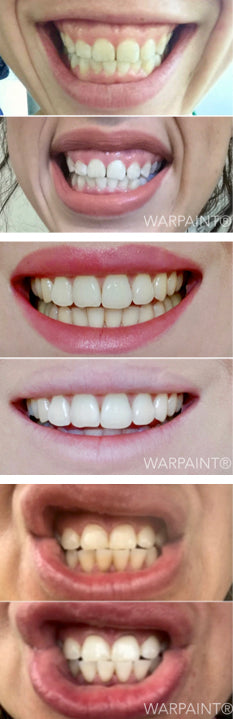 charcoal teeth whitener works best activated charcoal 