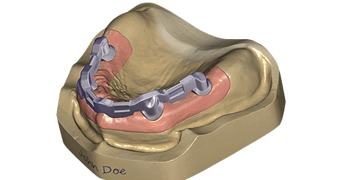 exocad Bar (Flex Initial Purchase)