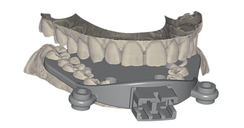 exocad Jaw Motion Import (Perpetual Initial Purchase)