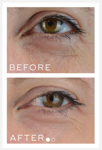 Before and After results Medik8 Crystal Retinal 6