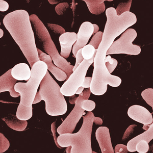 Bifidobacterium breve probiotic