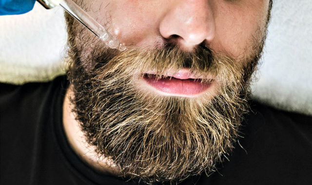 Hogyan növeszt szakállat a minoxidil