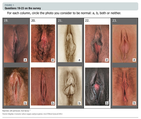Survey question showing pictures of vulvas from the Petals project