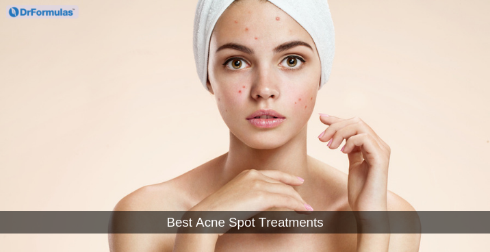 Best Acne Spot Treatments