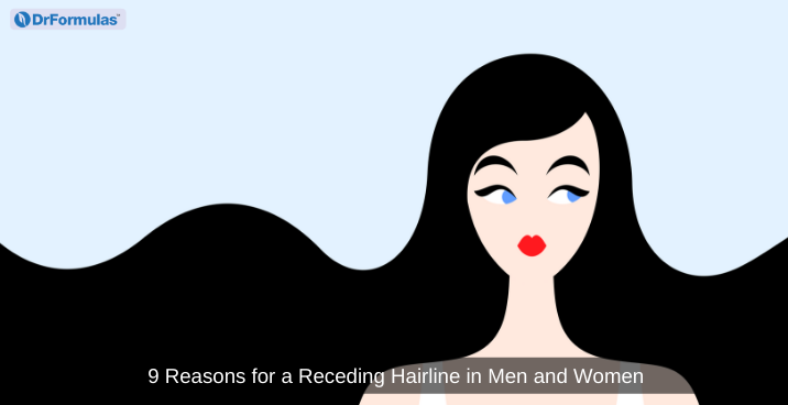 receding hairline women