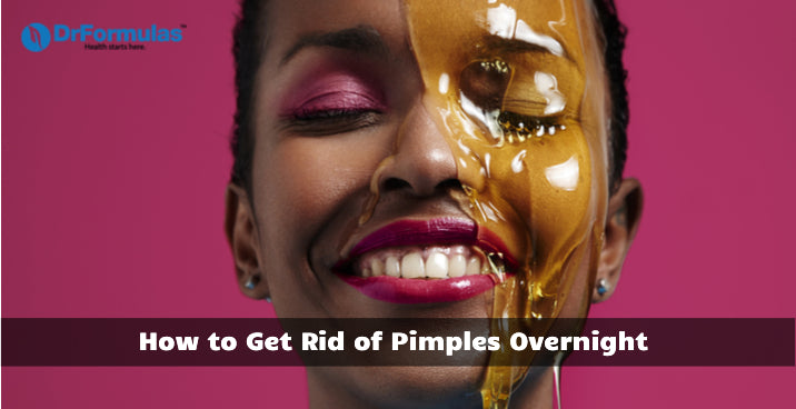 How to Get Rid of Pimples Overnight 