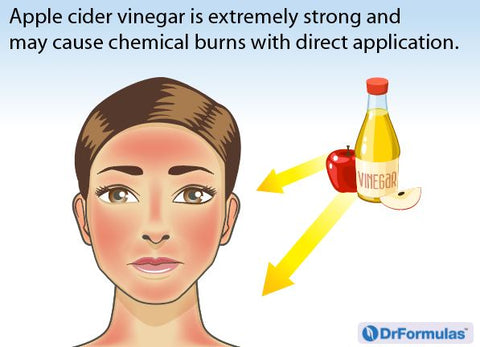 acv for acne
