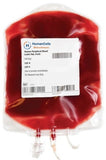 HIV-1 Leuko Pak / Whole Blood / Plasma